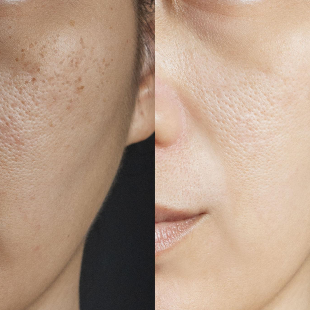 PRACTS Fade & Brightening Cream-DE